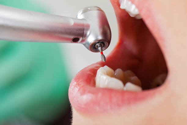 Best Emergency Dentist for Knocked-Out Tooth in Geneva, NY